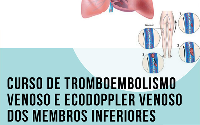 Curso de Tromboembolismo Venoso e Ecodoppler Venoso dos Membros Inferiores – Inscrições Abertas