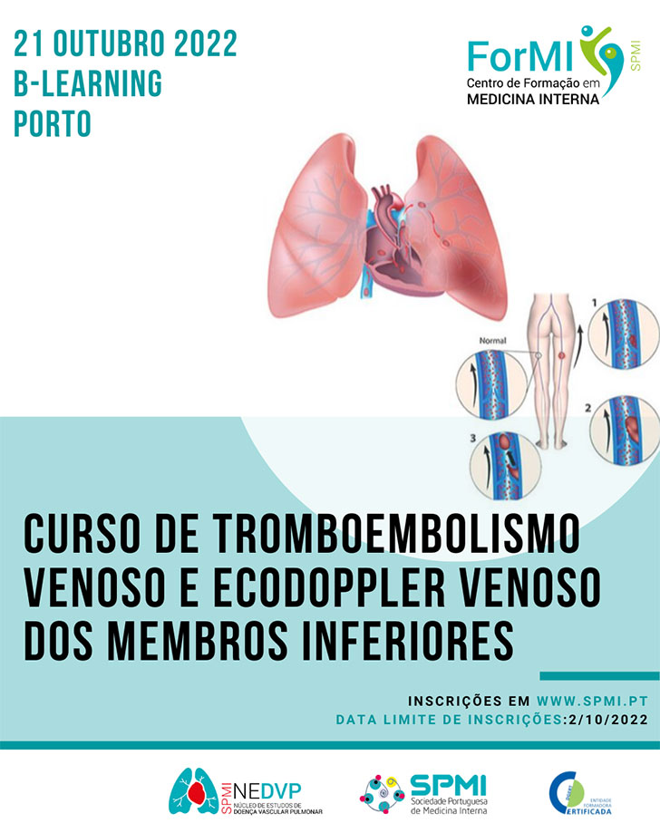 Curso de Tromboembolismo Venoso e Ecodoppler Venoso dos Membros Inferiores - Inscrições Abertas