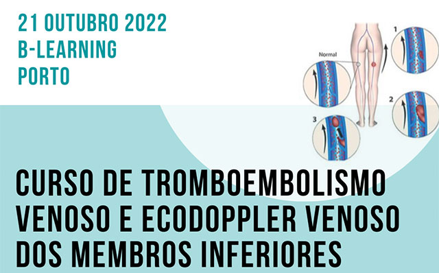 Curso de Tromboembolismo Venoso e Ecodoppler Venoso dos Membros Inferiores – Inscrições Abertas