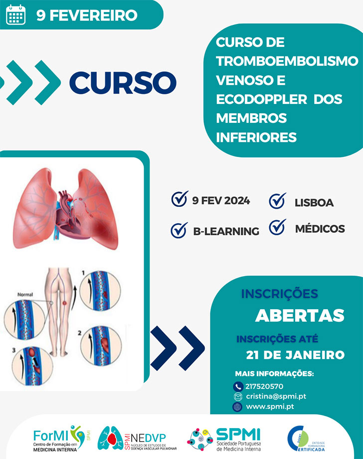 Curso de Tromboembolismo Venoso e Ecodoppler Venoso dos Membros Inferiores - Inscrições Abertas